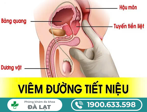 Hình ảnh minh họa